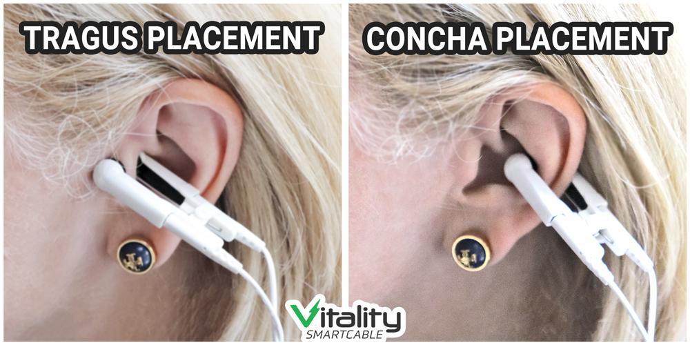Vitality Smartcable® COMBO Replacement Ear Clips (Set of 2)